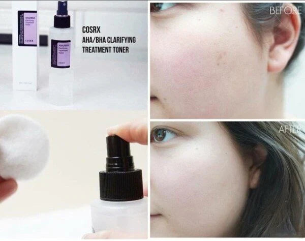 Tónico exfoliante Cosrx AHA/BHA Clarifying Treatment Toner 150ml