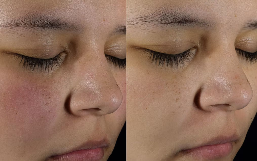 Exfoliante piel perfecta Paula’s Choice  2% BHA Liquid Exfoliant 118 ml