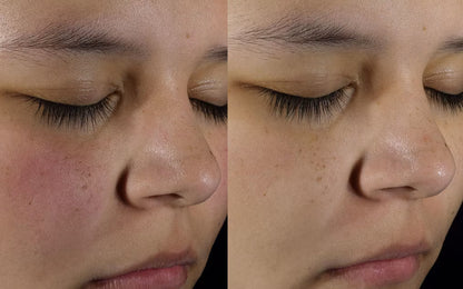 Exfoliante piel perfecta Paula’s Choice  2% BHA Liquid Exfoliant 118 ml