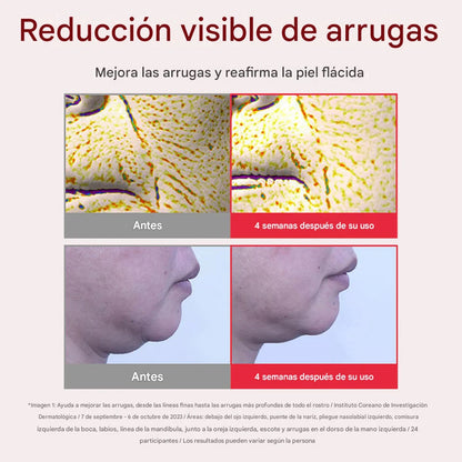 Crema facial antiedad Centellian24 Madeca Cream Time Reverse 50ml