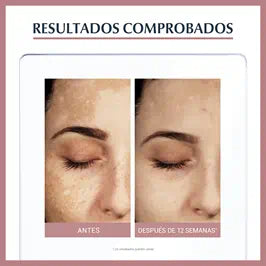 Serum Despigmentante con Thiamidol Eucerin Anti-Pigment Dual Serum Facial 30ml