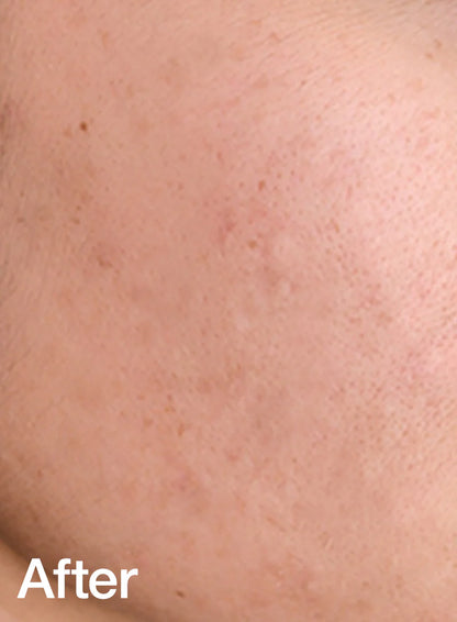 Tónico Calmante Anua Heartleaf 77% Soothing Toner