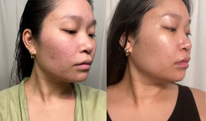 Sérum Iluminador con Niacinamida Anua Peach 70% Niacinamide Serum