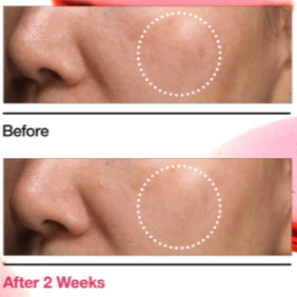 Sérum de niacinamida 10% + TXA 4% Anua Niacinamide 10% TXA 4% Serum 30ml