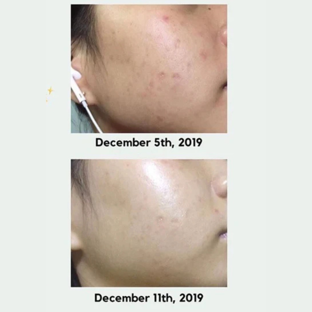 Sérum iluminador para corrección de manchas oscuras Axis-Y Dark Spot Correcting Glow Serum 50 ml