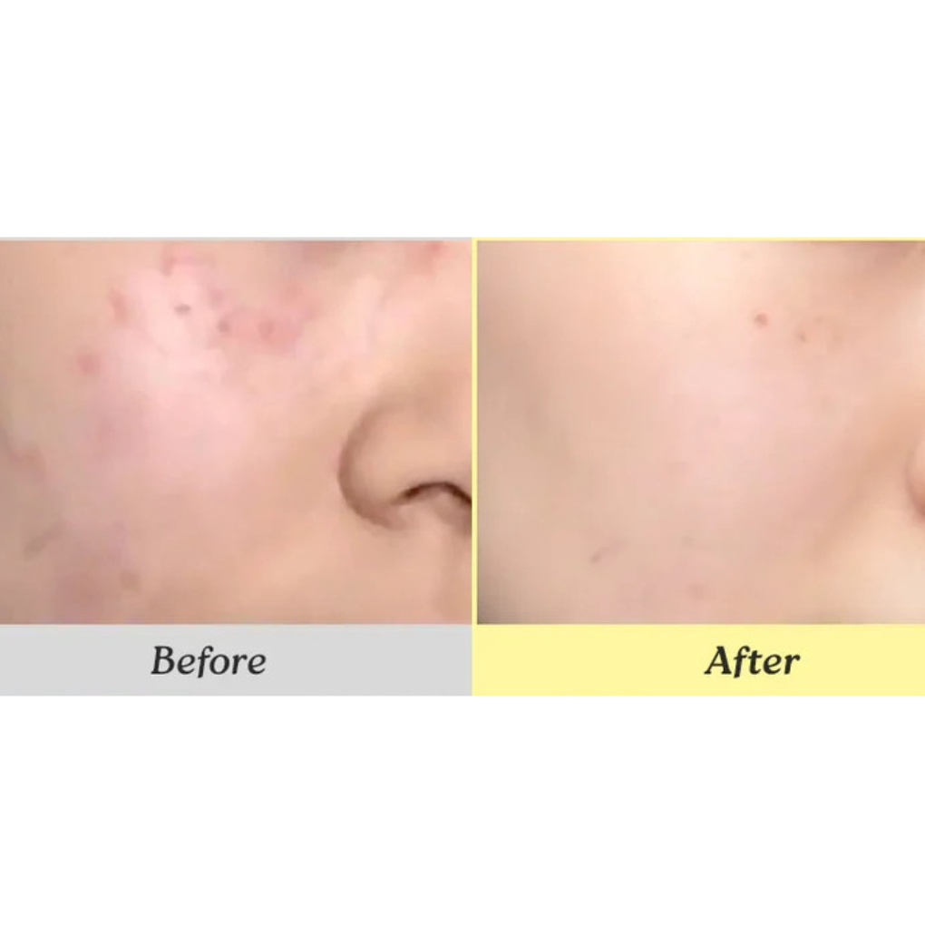 Crema Calmante e hidratante 345 Dr. Althea 345 Relief Cream 50ml