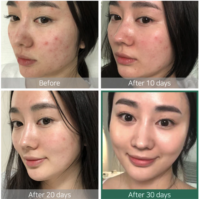 Tónico exfoliante 30 días SOME BY MI - AHA BHA PHA 30 Days Miracle Toner 150ml