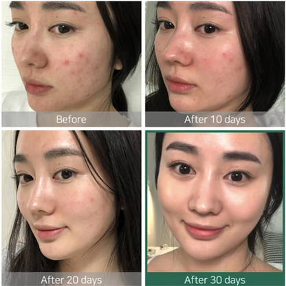 Tónico exfoliante 30 días SOME BY MI - AHA BHA PHA 30 Days Miracle Toner 150ml