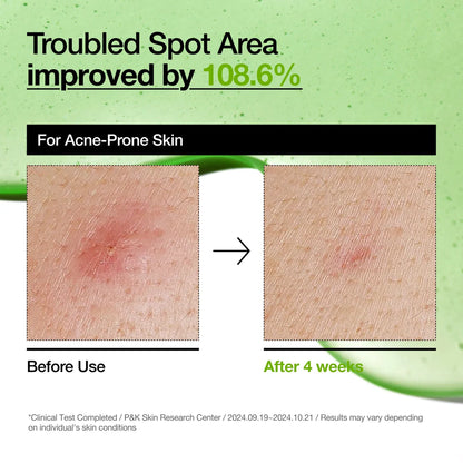 Sérum Anti-rojeces con Ácido Azelaico 10% y Ácido Hialurónico Anua Azelaic Acid 10 Hyaluron Redness Soothing Serum 30ml