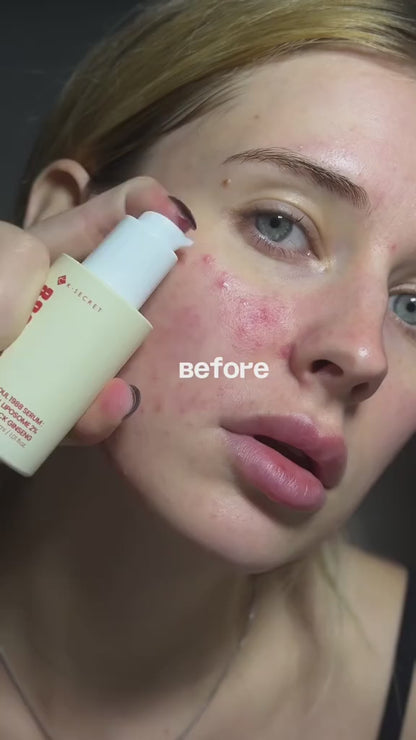 Sérum con retinal para arrugas y textura K-Secret SEOUL 1988 Serum Retinal Liposome 2% + Black Ginseng 30ml